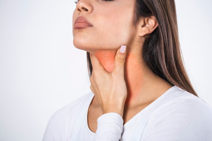 Hyperthyroidism