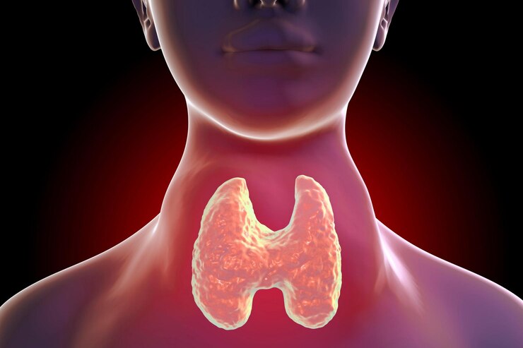 Hypothyroidism