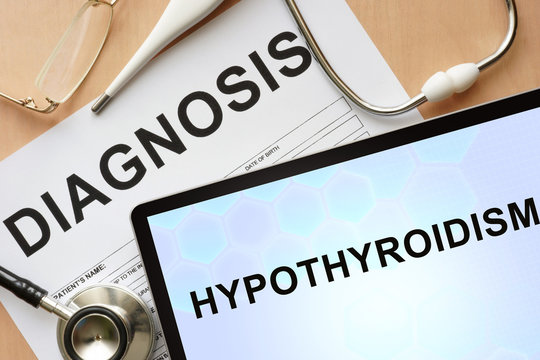 Hypothyroidism: What You Need To Know And How To Manage It