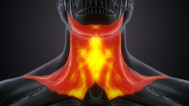 Multinodular Goitre: What You Need To Know About This Thyroid Condition