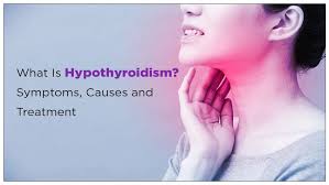 Best Hypothyroidism Treatment in Naraina