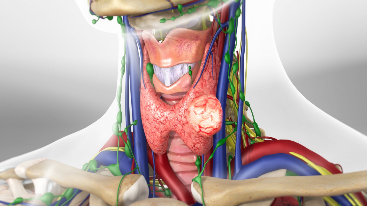 Best Thyroid Nodule Treatment in Moti Nagar